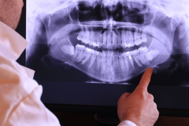 Best Emergency Treatment for Jaw Pain or Injury in Beltsville, MD
